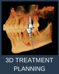 3D TREATMENT PLANNING sirona cone beam CT